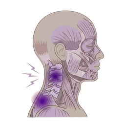 Tratamiento fisioterapia cabeza y cuello