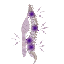 Tratamiento fisioterapia Columna vertebral